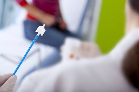 Avances en la detección del cáncer cervical: el papel de las pruebas de VPH de autocolección