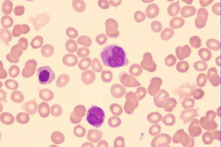 Babio lanza una solución de mancha Giemsa de alta calidad para laboratorios globales