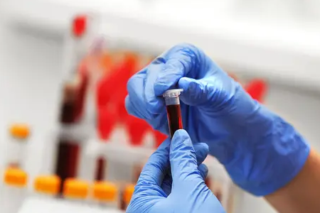 BABIO lanza prueba rápida de embarazo bovino de fluorescencia