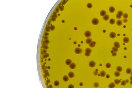 El caldo BABIO Mueller-Hinton respalda pruebas confiables de susceptibilidad a los antimicrobianos